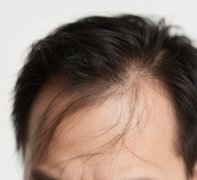 洗發(fā)水成分揭發(fā)！小心這些洗發(fā)水有害成